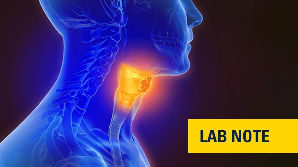 blue xray throat tumor lump with lab note written in blue with yellow overlay on bottom right