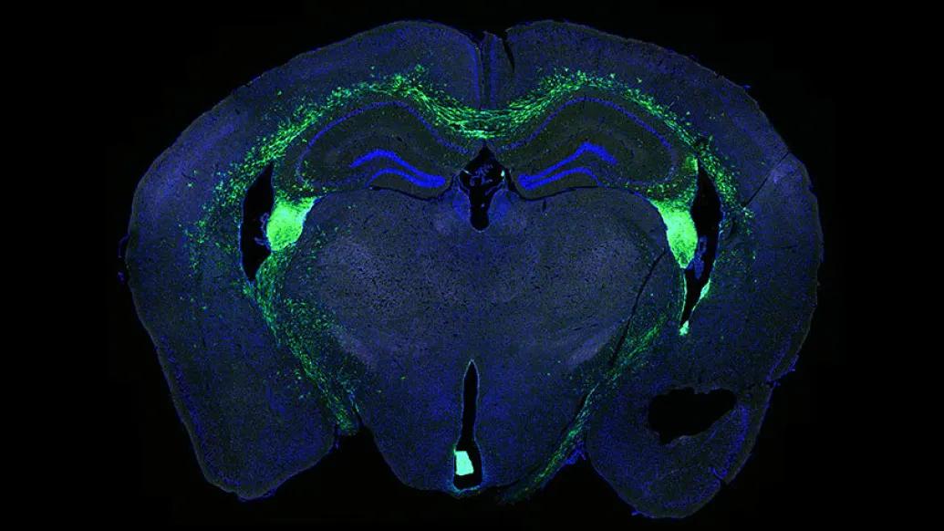 brain stem blue green slice