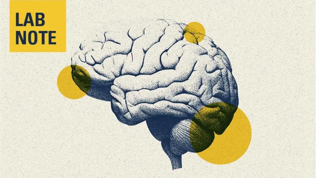 brain lab note