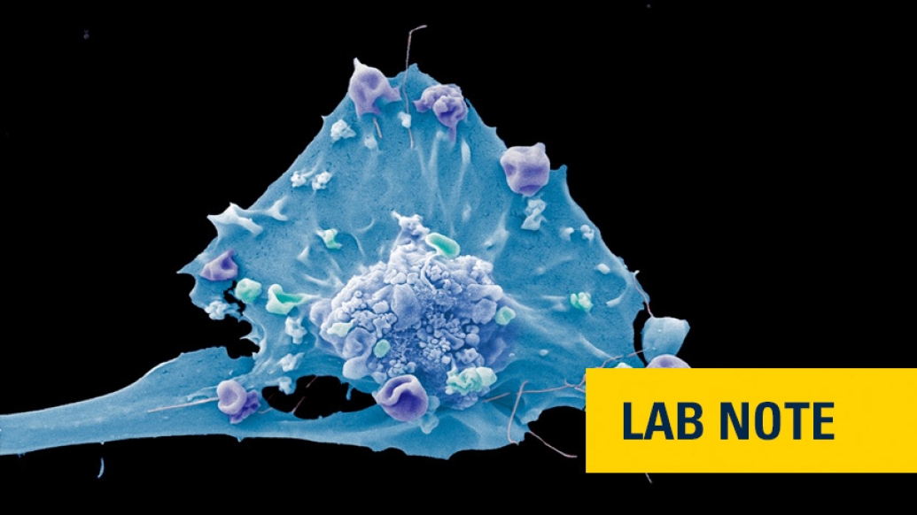 blue breast cancer cell image withia yellow badge saying lab note in blue font