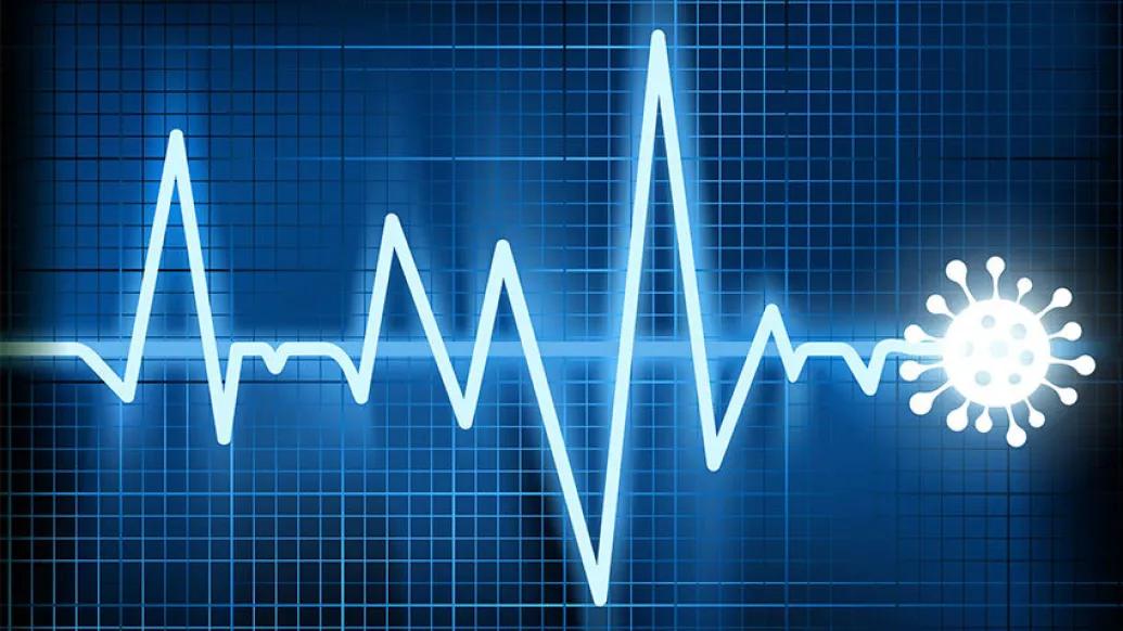 covid cell pulse line ekg