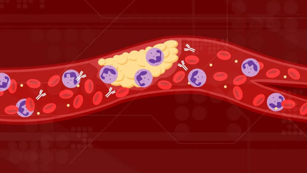 red blood vessel with purple clot and antivodies floating inside
