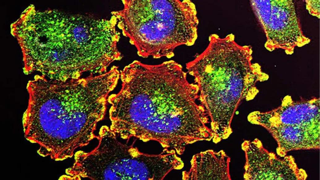 Multi color of microscopic Cancer cells