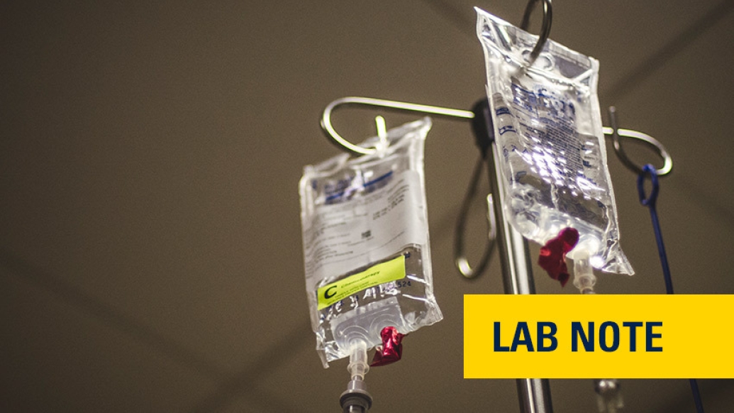 chemo medicine bags hanging on IV pole with lab note badge in yellow in background