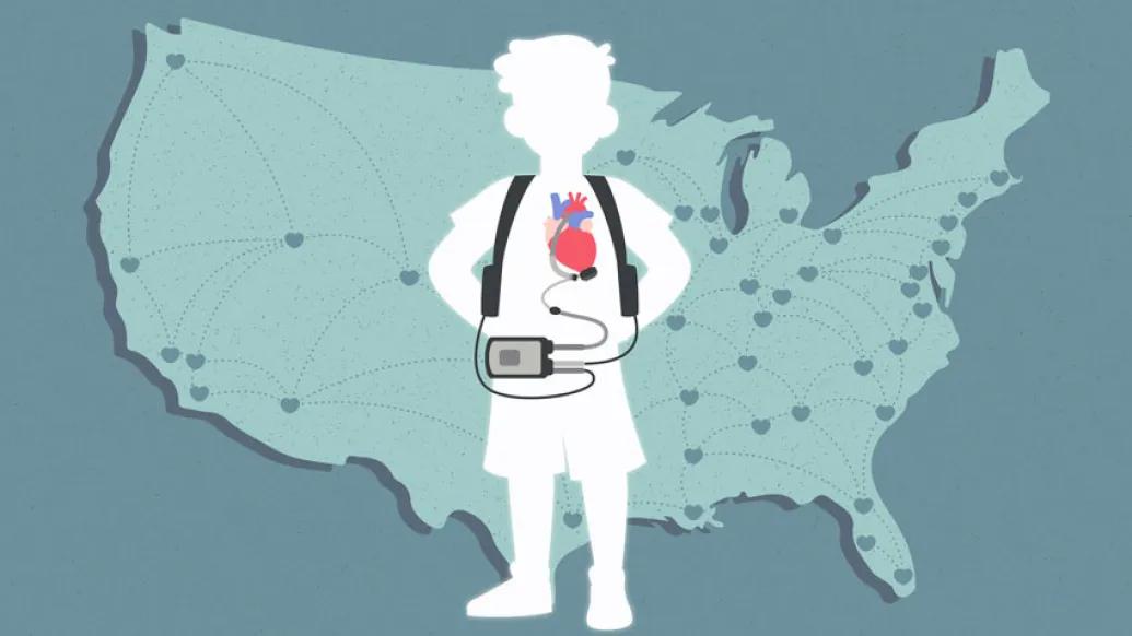 Child heart pump map behind of America in blue