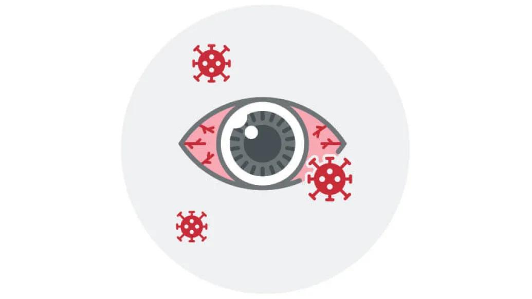 Covid with an eye