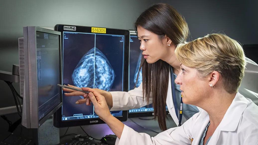 doctors pointing to computer scan of mammogram on the computer