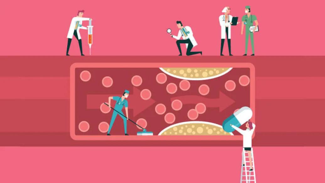 Doctors trying to unclot a clogged artery 