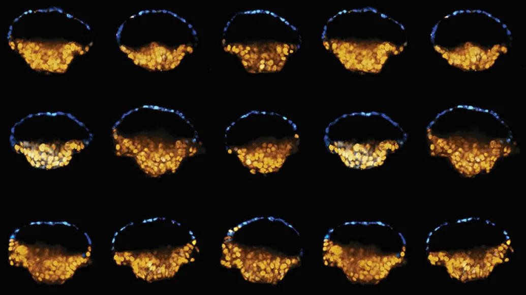 Embryo-like Structures