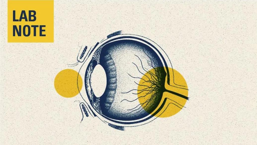 eye lab note