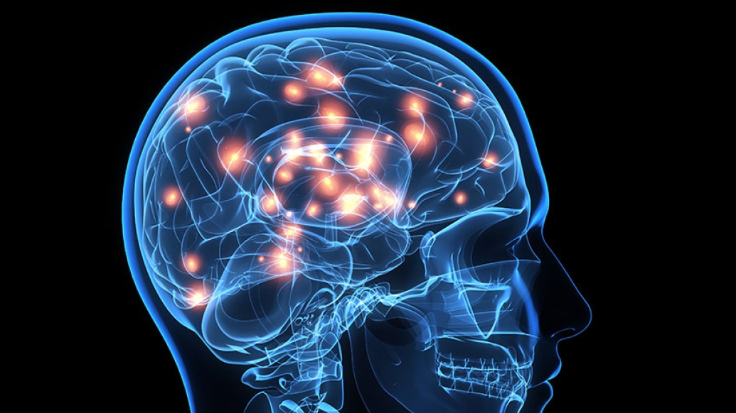 Brain 
