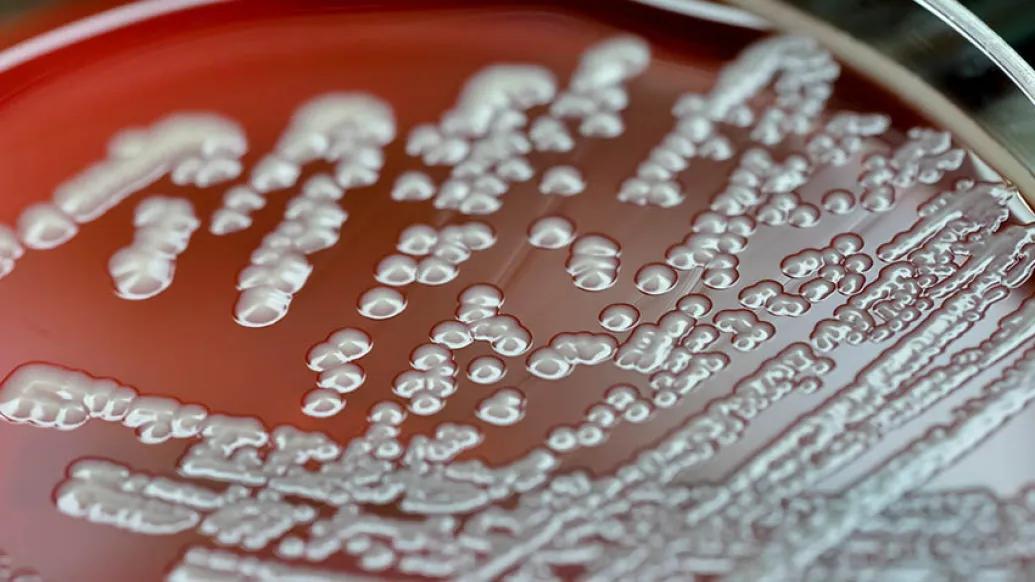 Petri dish