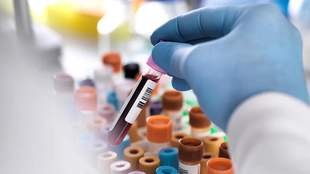 gloved hand holding blood vial