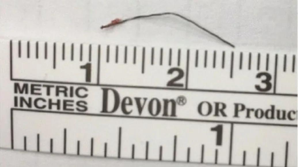 Ruler