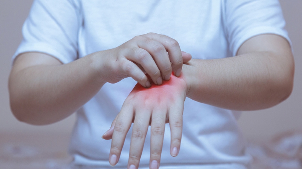 hands scratching wrist inflammation red