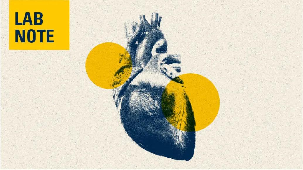 heart image lab note navy blue yellow 