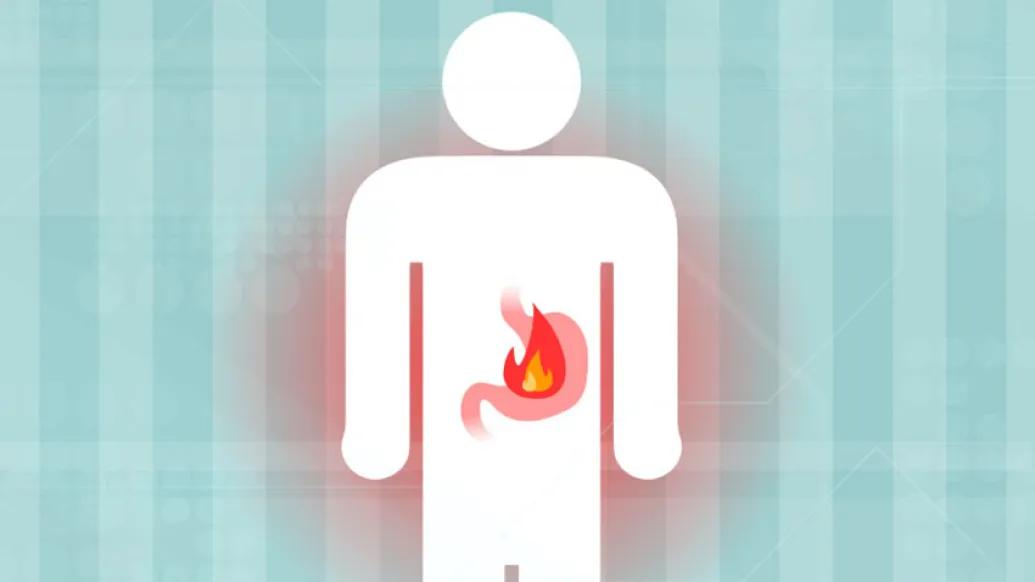 Heartburn image