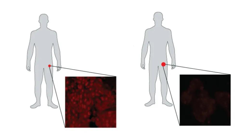 human silhouette groin zoom prostate 