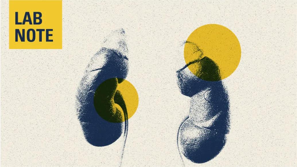 kidneys lab note