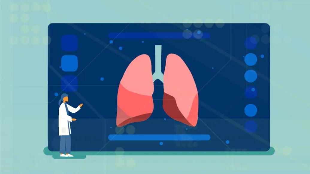 image of lung cancer scanning graphic image