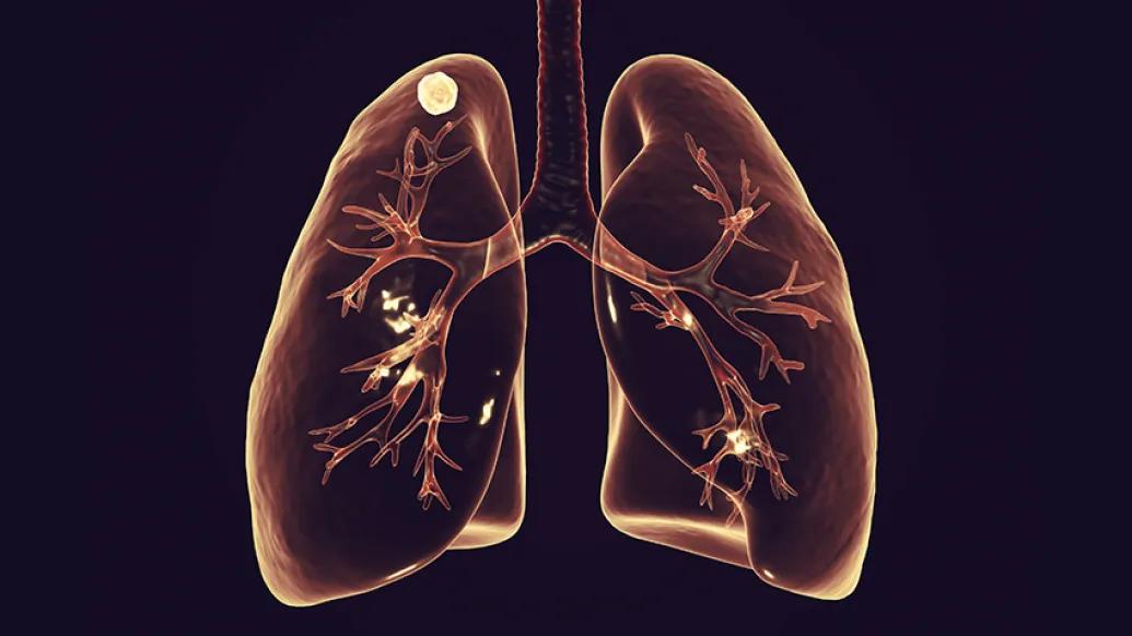 lungs 3d model