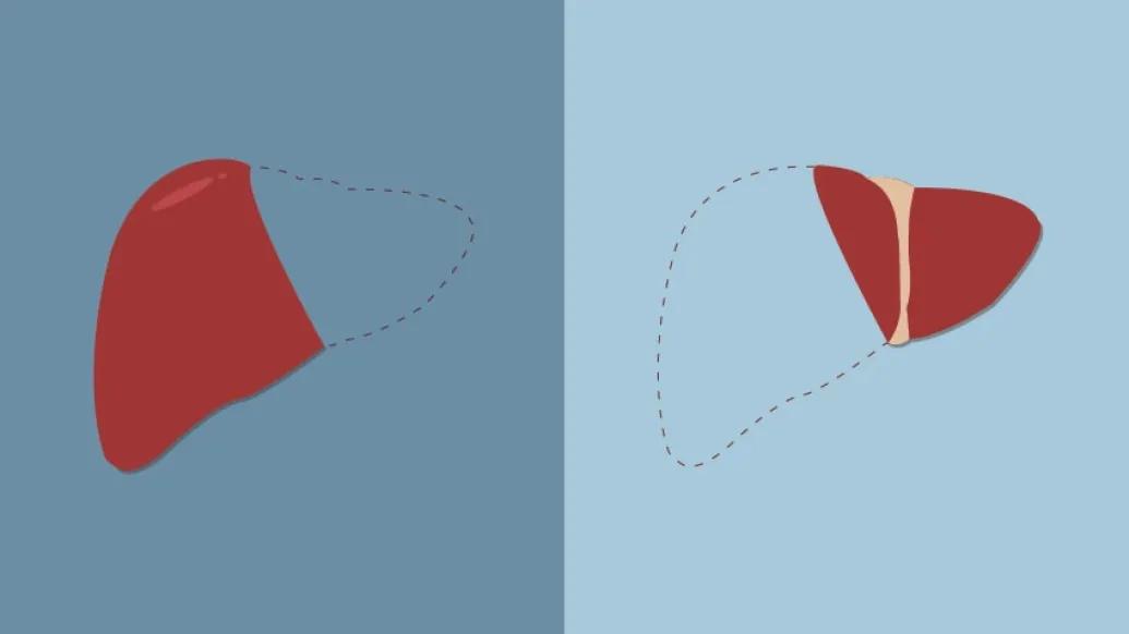 drawing of kidney in red and the other just outlined with blue background in two different shades of blue