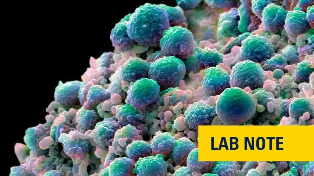 teal microscopic cell prostate cancer