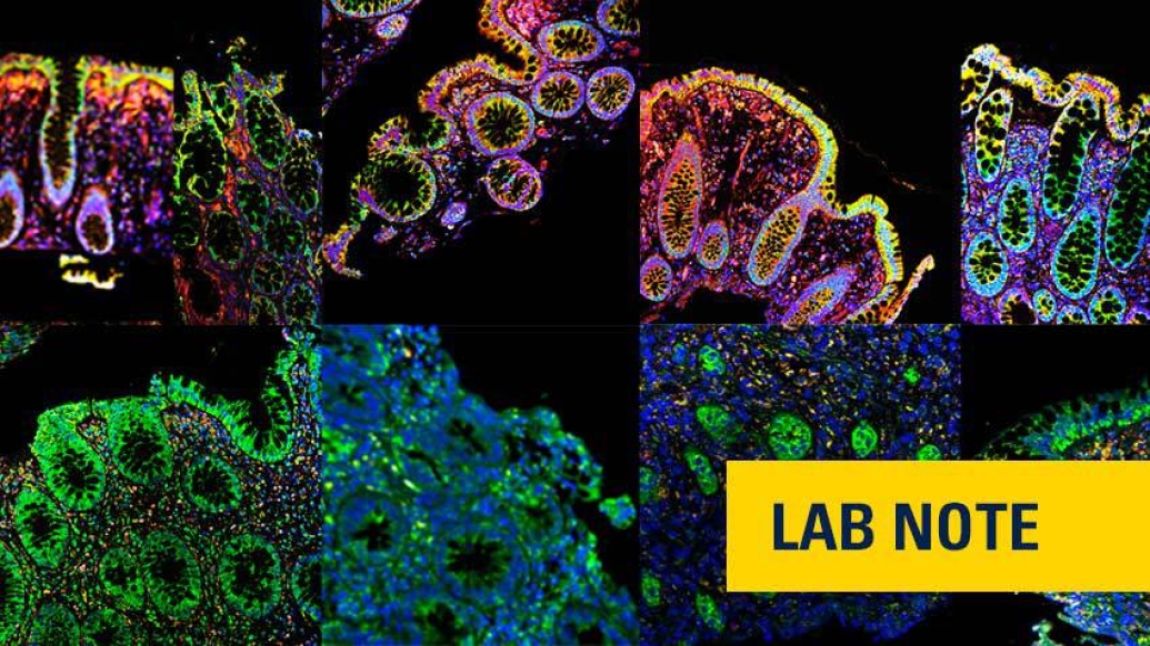 microscopic colorful rainbow cells black background and yellow badge on bottom right and blue lettering saying lab notes