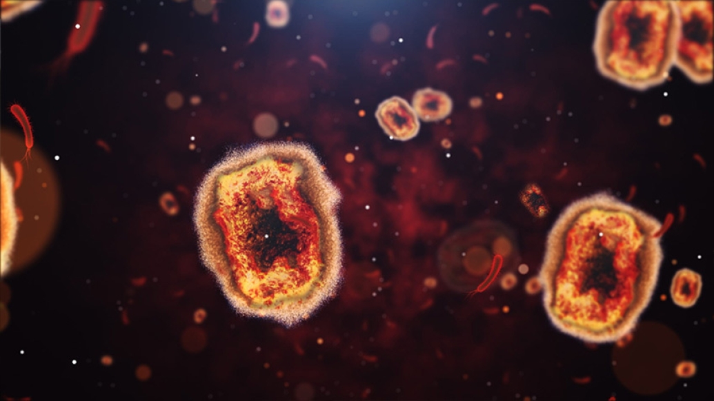 monkey pox virus cells microscopic orange cells