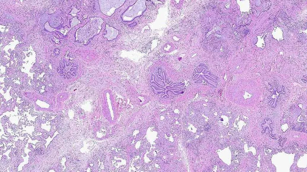pink purple cellular microscopic slide