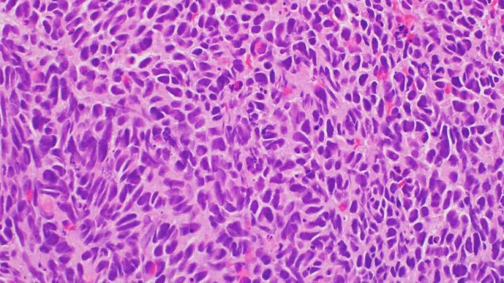pink purple spongy tissue under microscope view