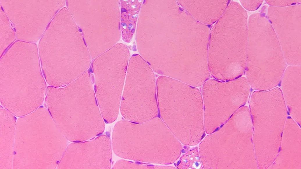 Pink Glycogen under microscope