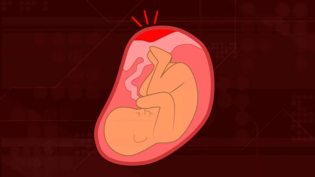 black background baby in red placenta with red spot at top signaling something is wrong