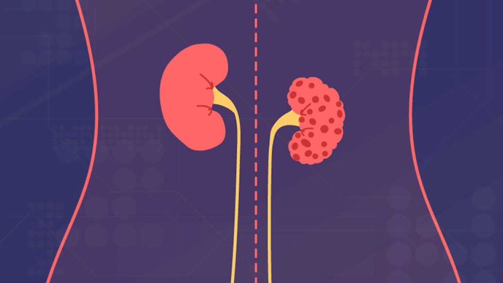 Image of kidneys