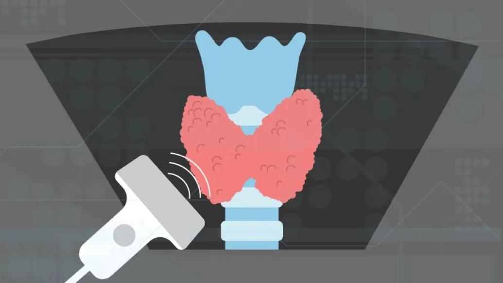 Graphic of Thyroid