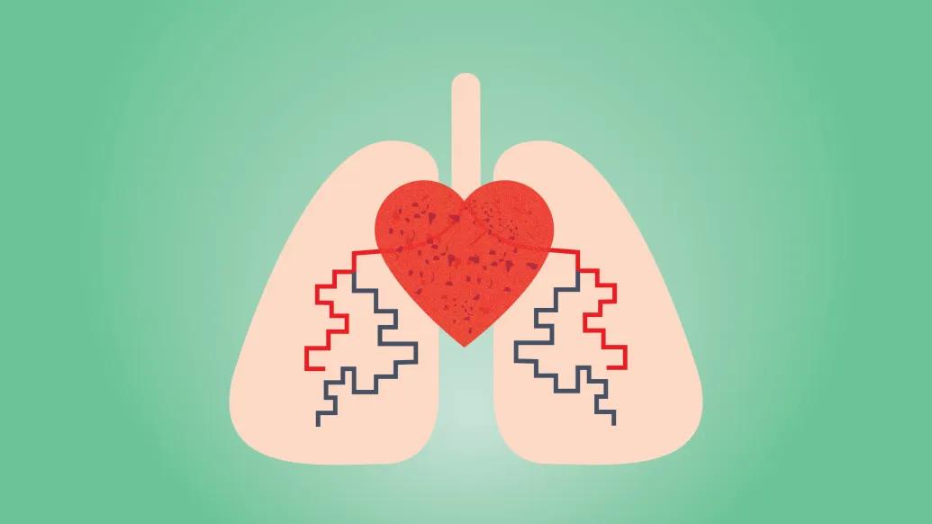 Graphic of a heart and lungs with pulmonary hypertension