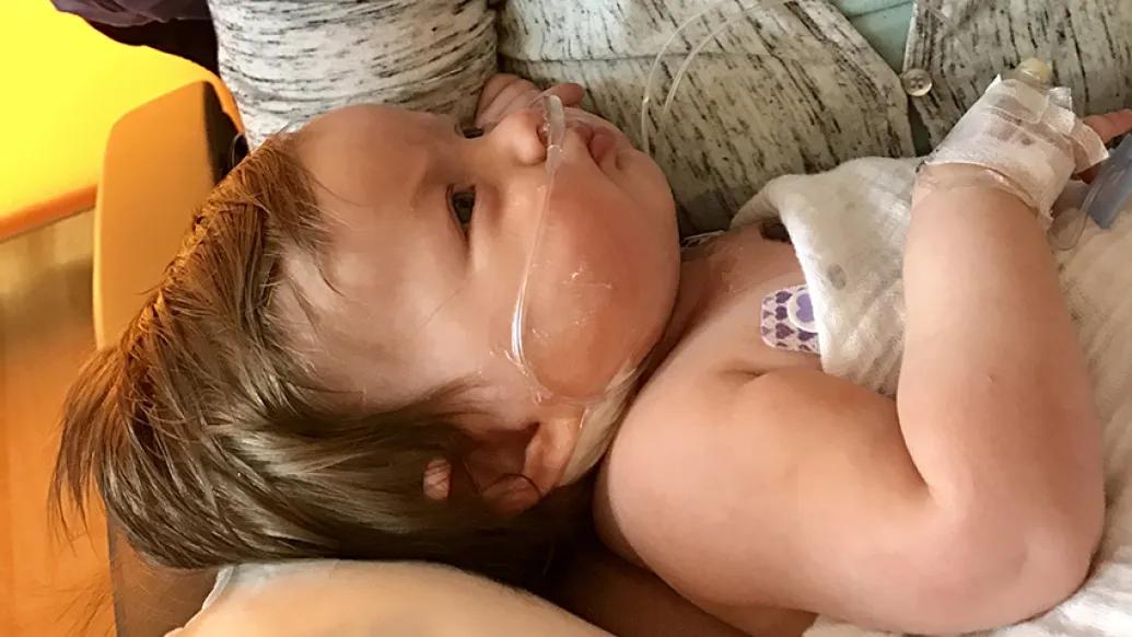 Four month old Nina after open heart surgery to treat tetralogy of fallot