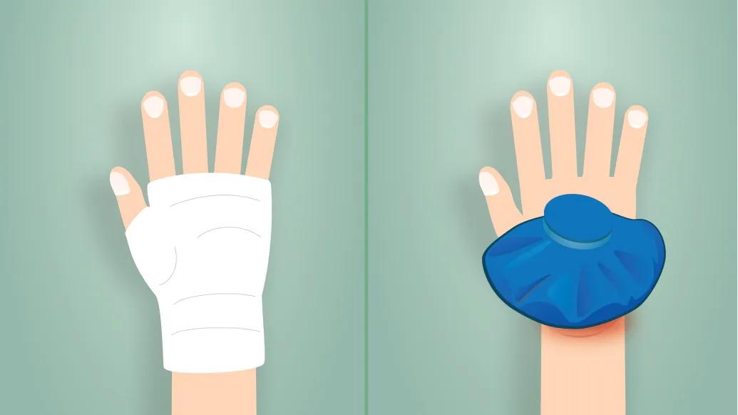 Two different hand injuries requiring acute care