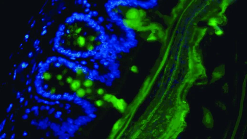 Microscopic image of gut bacteria eating the colon lining