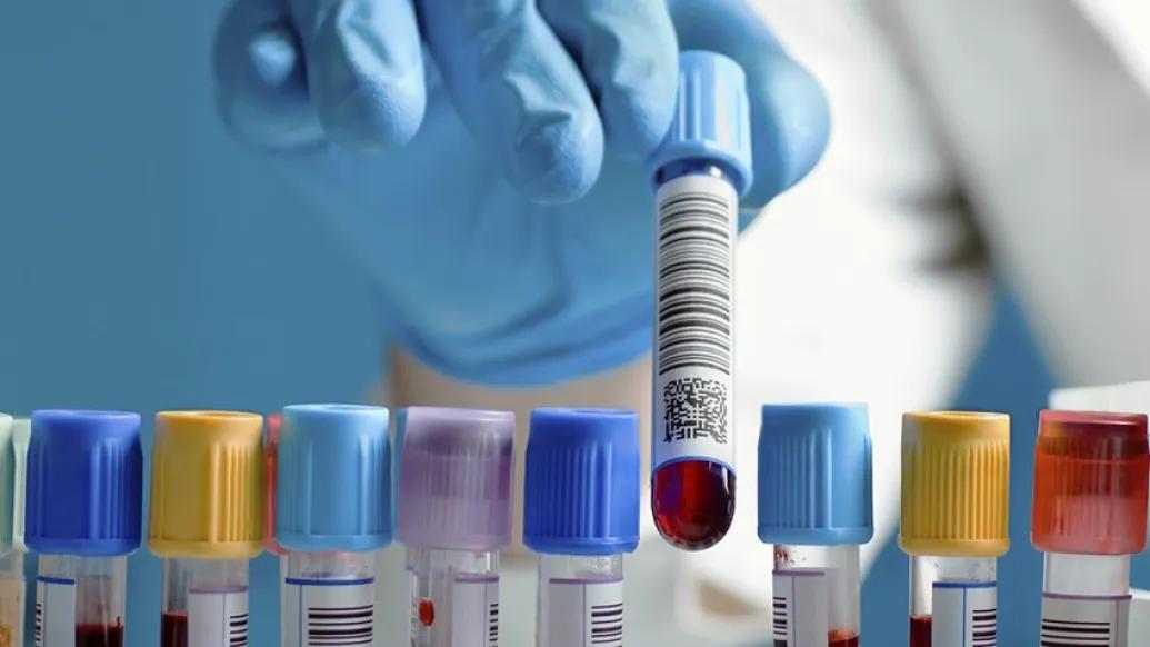 Blood tests for inherited thrombophilia