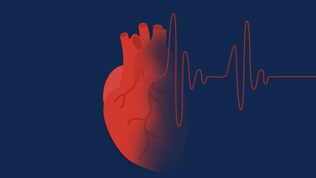 Graphic of a heart with atrial fibrillation