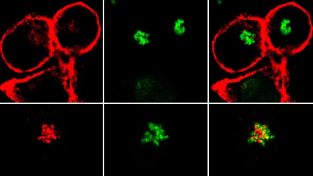 Nef proteins stopping healthy proteins form alerting the immune system of HIV