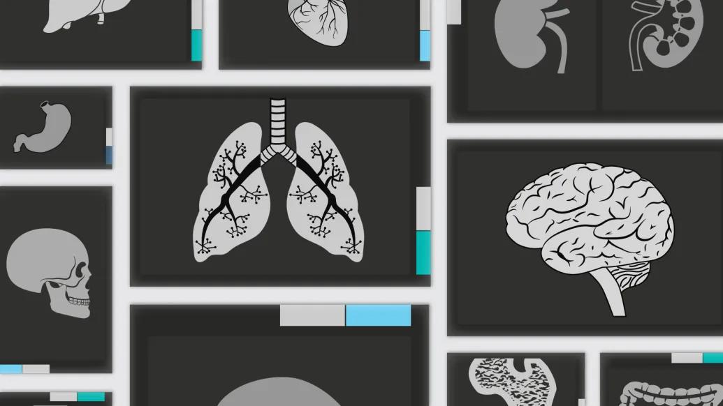 Illustration of x-ray imaging