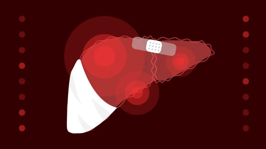 liver with injuries