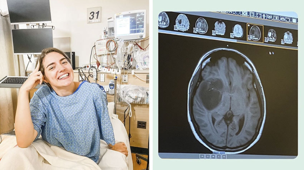 woman sitting on hospital bed smiling in blue gown and brain scan on right with tumor in it