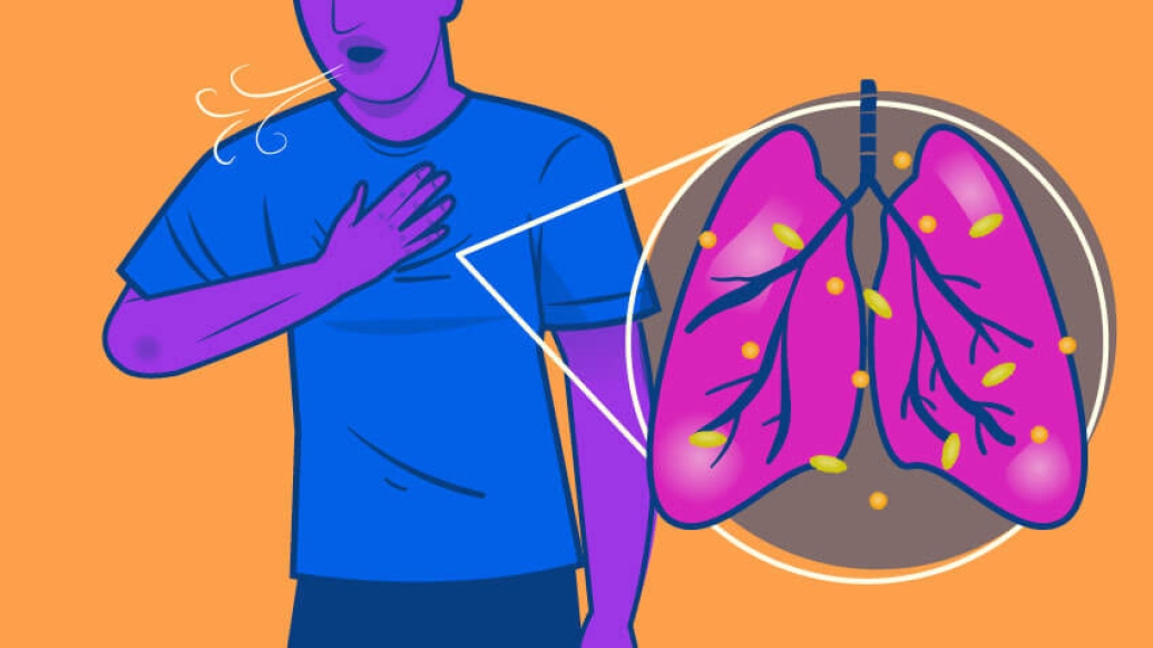 Person in blue shirt touching chest, orange background, pink lung image