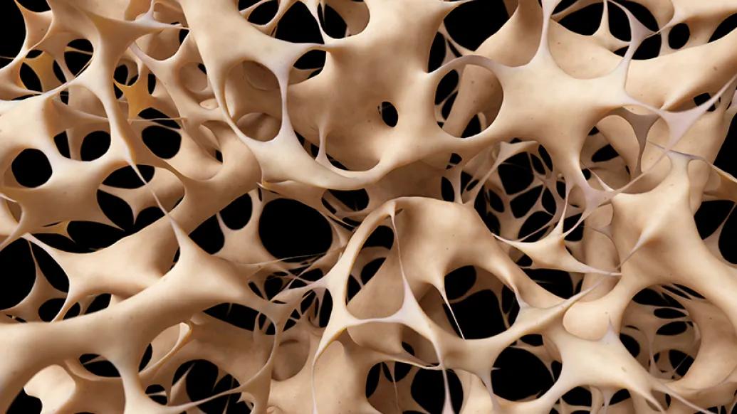 Bone mesh