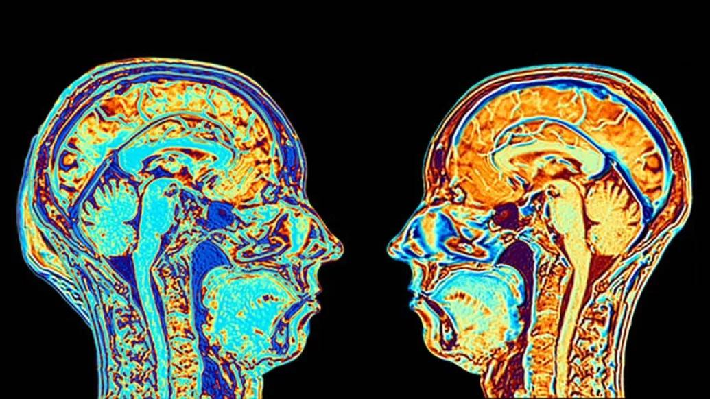 two colorful brain scans