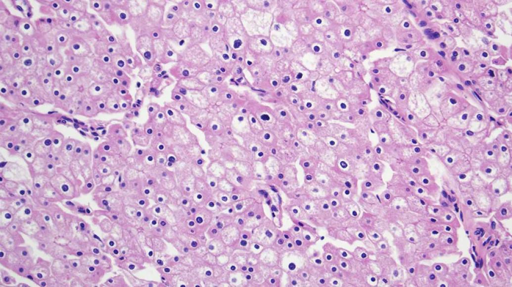 Kidney cells strained