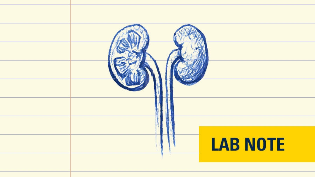 drawing in blue ink of kidneys on lined paper with lab note wording bottom right in blue with yellow background